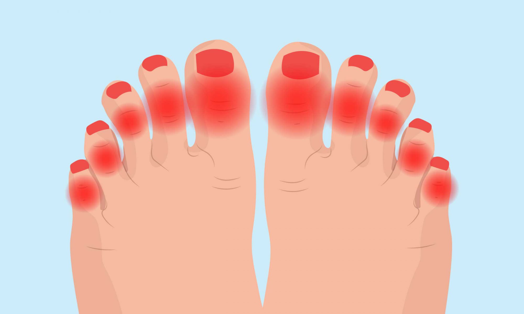 Arthritis in Your Feet Causes, Symptoms, and Treatment DeNiel Foot
